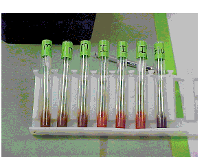 carbohydrate test