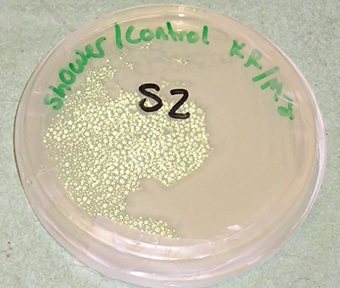 Agar plate inoculated with bacteria